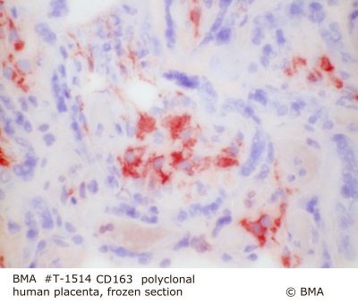 hp_t-1514_cd-163_polyclonal_human_placenta_frozen_.jpg