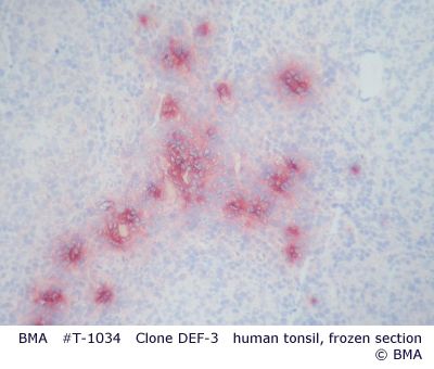 hpt-1034_002_def-3_human_tonsil_frozenbild3.jpg