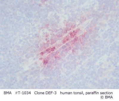 hpt-1034_003_def-3_human_tonsil_paraffin__005.jpg