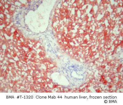 hpt-1320_mab_44_human_liver_frozen__003.jpg