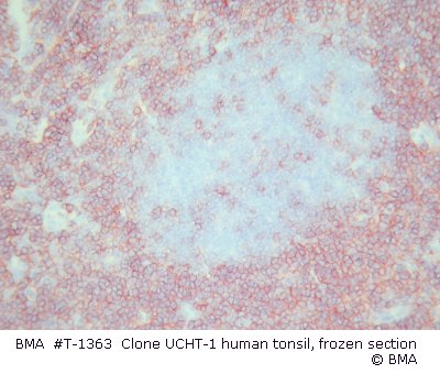 hpt-1363_001_ucht-1_human_tonsil_frozen_004.jpg