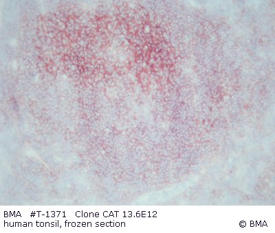 hpt-1371_001_cat_13.6e12_human_tonsil_frozen_004.jpg