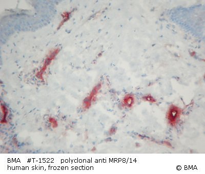 hpt-1522_polyclonal_mrp8-14_human_skin_frozen_904_.jpg