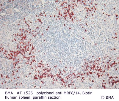 hpt-1526_001_polyclonal_mrp8-14__spleen_human_para.jpg