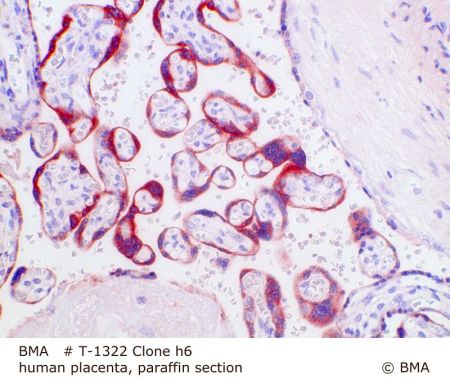 ph_t-1322_h6_human_placenta_paraffin_prot_0001.jpg