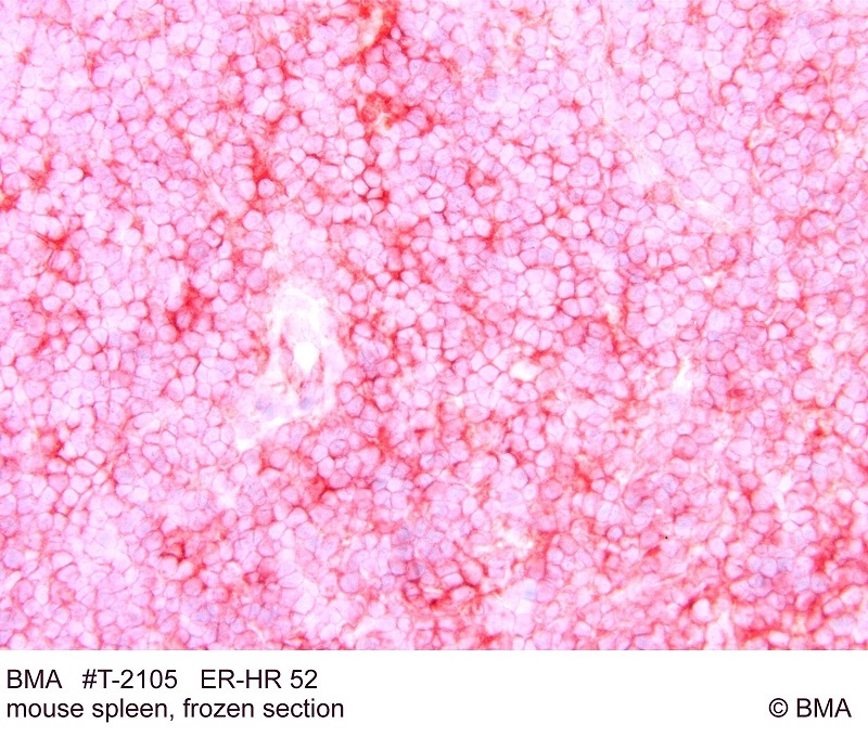 t-2105_erhr-52_mouse-spleen_frozen_bild_295_1.jpg