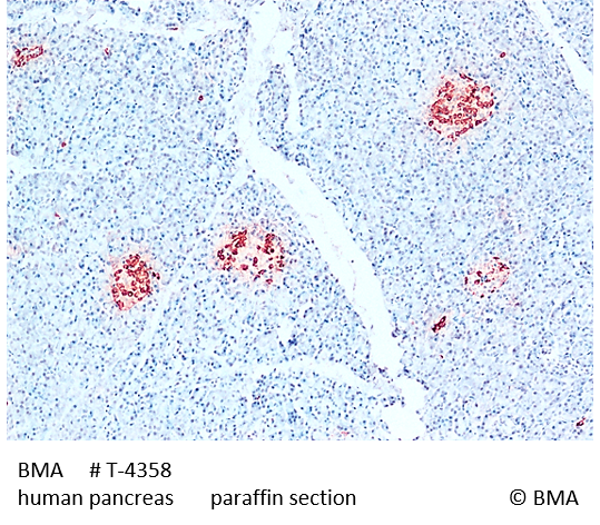 t4358_hu_pan.png